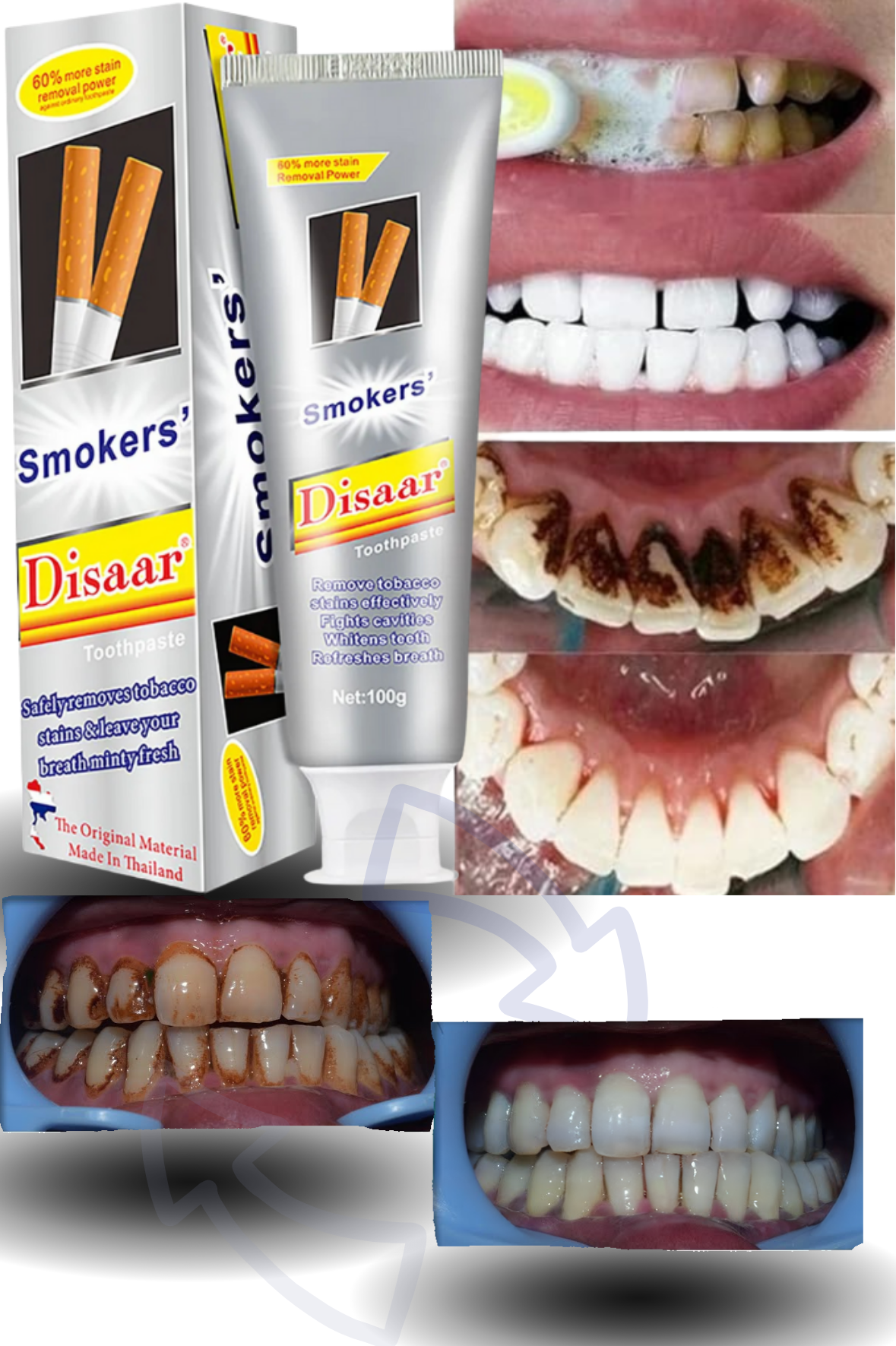 Blanqueador Dental Smoker?s Disaar