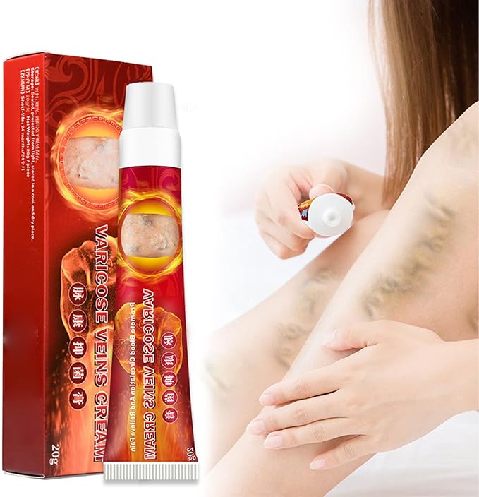 Varice 2 Veins Cream Pomada